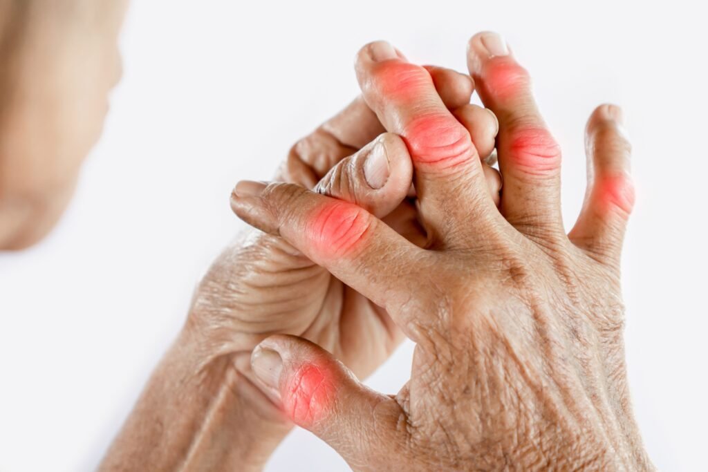 Best Unani Medicines for Joint Inflammation and Arthritis